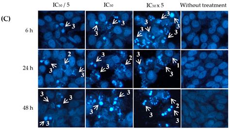 In Vitro and In Silico Analysis of the Anticancer Effects of ...