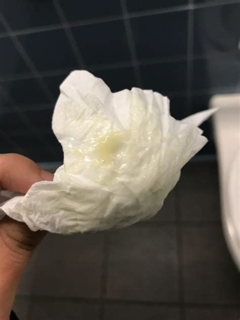 Abdominal pain and yellow discharge(no smell no itch) - Glow Community