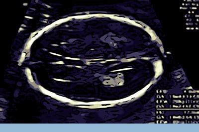 Image result for Biometry Ob