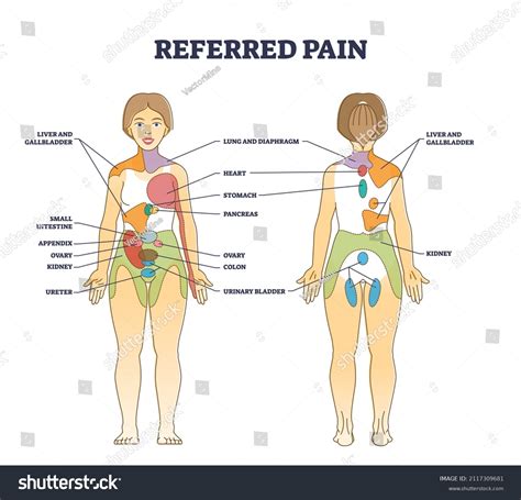 Liver Pain Location Diagram