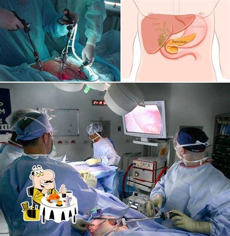 Dr SM Sivaraj - Best Gastroenterologist Surgeon in Chennai/Gall Bladder ...