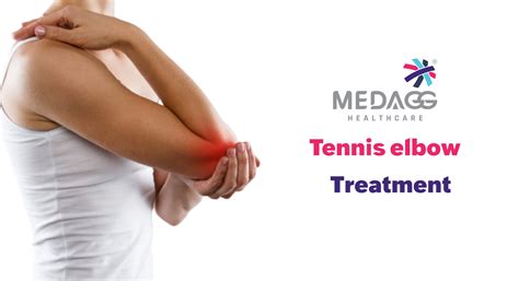 Tennis Elbow Treatment