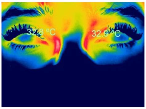 Applications of Infrared Thermography in Ophthalmology