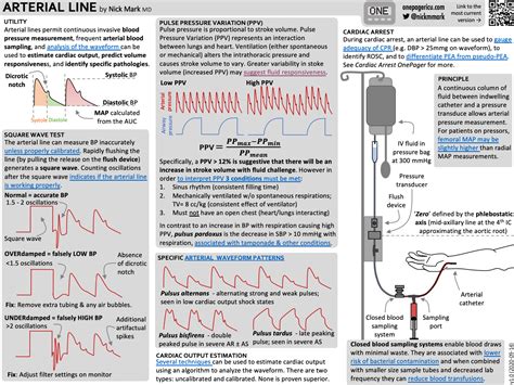 Arterial Line Venous Arterial Line Set Unilene