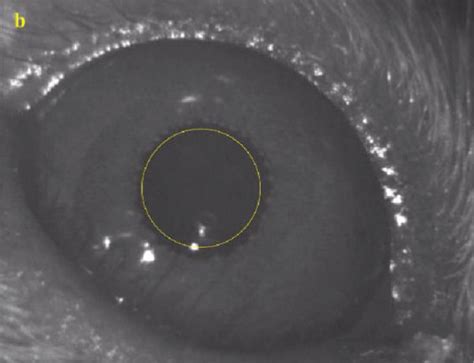 Image result for Vor Test Questions