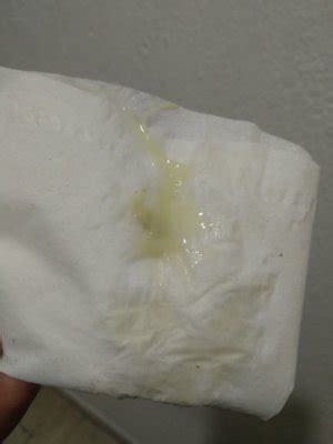 Flujo blanco día del periodo - Page 2 | BabyCenter