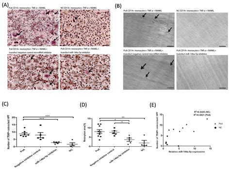 MiR-146a-5p Expression in Peripheral CD14+ Monocytes from Patients with ...