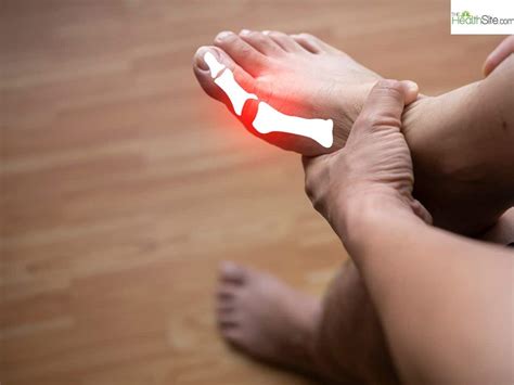 Uric Acid Control Tips: 5 Vegetables to avoid to keep in check Purine ...