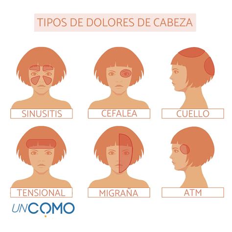 Estos Son Los 10 Tipos De Dolores De Cabeza M S Comunes Sus Causas Yprocesos Del Dolor