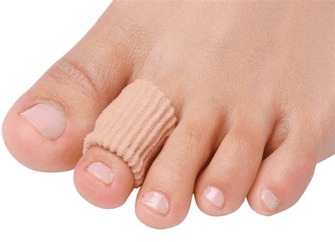 Corns | Foot Specialist Toronto | Feet First Clinic