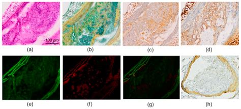 Amyloid-Targeting PET Tracer [18F]Flutemetamol Accumulates in ...