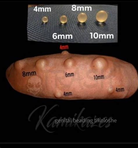 Beads Under Skin at Richard Rebecca blog