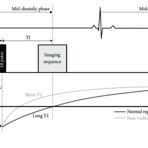 Image result for LGE Stat Tutorial