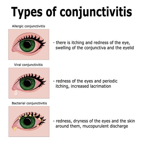Optometry North Bay - Eye Health