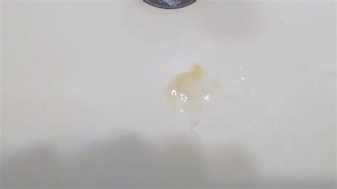 Coughing Up Brown Mucus In The Sink - YouTube