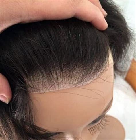 DreamExim 100% Natural Men Frontal/line /Patch for Covering Male ...