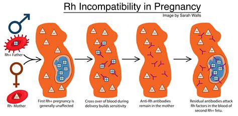 Incompatibility: Định nghĩa, Cách sử dụng và Ví dụ minh họa