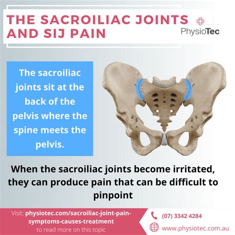 Sacroiliac joint pain: Symptoms, Causes, Treatment