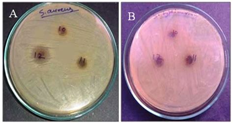 Fig. 2: Antibacterial activity of leaf extract of C. guianensis: 10, 11 ...
