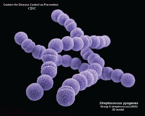 PANDAS: A Story of Molecular Mimicry | Streptococcal infection, Streptococcus pneumoniae ...
