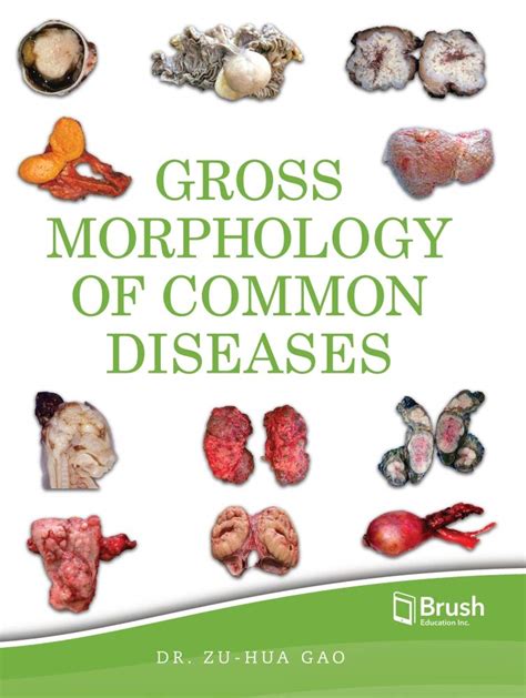 Buy Gross Morphology of Common Diseases Book Online at Low Prices in ...