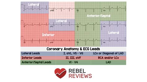 Relationship Of 12 Lead Ecg To Coronary Artery Anatomy 12 Lead ECG