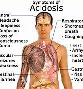 Image result for acidotic