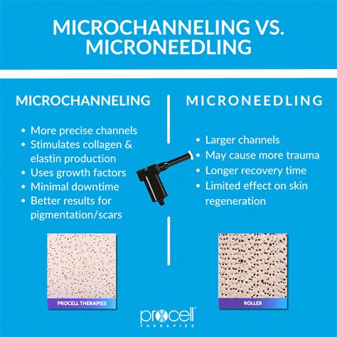 Procell Microchanneling for Skin - Renew Me