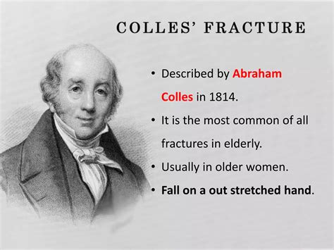 Distal End Radius Fractures - Colles, Smiths & Bartons | PPTX