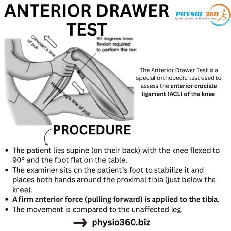 🦵 Anterior Drawer Test – Knee (ACL) Purpose: To assess the integrity of… | Dr.Sakthi Vinayagam ...