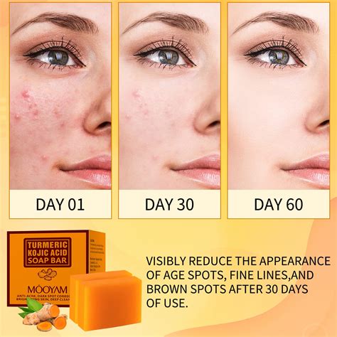 Jio Turmeric Soap at Mark Cox blog