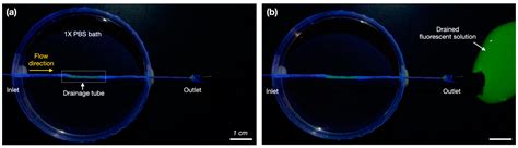 A 3D-Printed Aqueous Drainage Tube with an Expandable Inner Diameter to ...