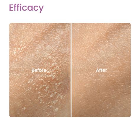 Goat Milk Soap For Skin Brightening | Earth Rhythm