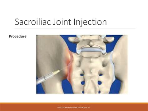 PPT - Interventional Spine Injections for Chronic Pain PowerPoint Presentation - ID:475524