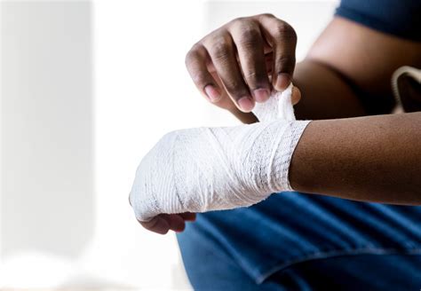 hand Injury - The Myers Law Firm