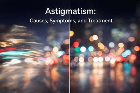Astigmatism: Causes, Symptoms, and Treatment - Eyeviser - causes of astigmatism
