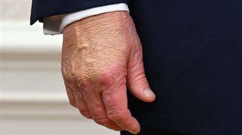 Viral Video Claims Trump Showing Signs of Dementia