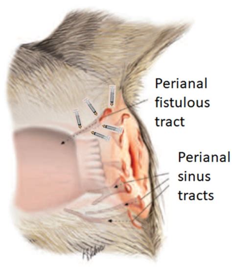 In Situ Treatment of Refractory Perianal Fistulas in Dogs with Low-Dose ...