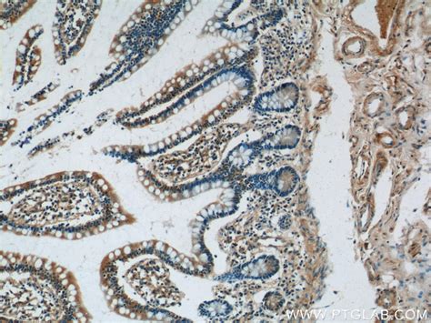 GPR44 antibody (25264-1-AP) | Proteintech