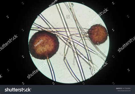Rhizopus Sp Under Microscope High Power Foto de stock 1617345085 ...
