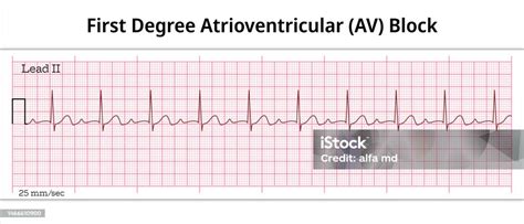 Image result for ACLS Code Blue Algorithm