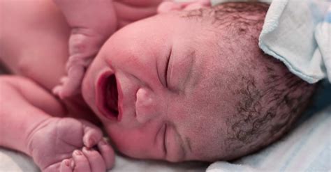 Bildergebnis für umbilical cord around neck complications