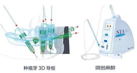 拉萨种植牙医院哪家好？弗莱堡/雅博仕/爱牙口腔包揽种牙前三名-口腔医院新闻-398口腔网