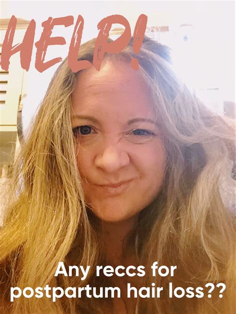 HELP! Tips for post partum hair loss? | Gallery posted by Meg 🦋 | Lemon8