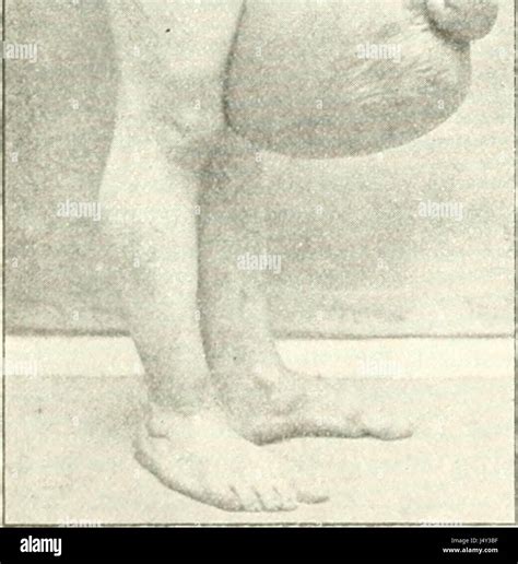 List 98+ Pictures Human Hermaphrodite Pictures Of The Organs Stunning