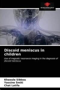 Discoid meniscus in children: Buy Discoid meniscus in children by ...