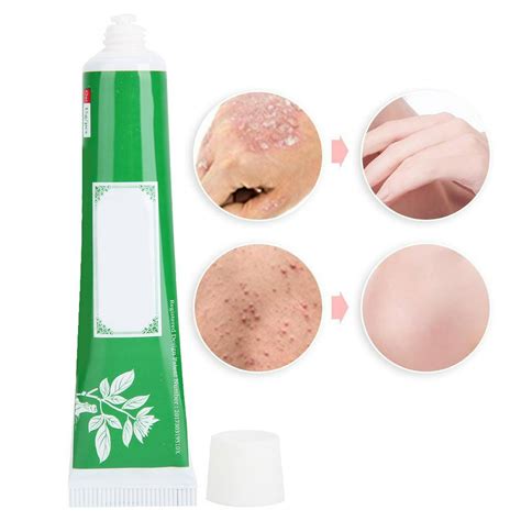 Crema De Hierbas Crema Para Eczema Cremas Para La Psoriasis Corporal Herbal Psoriasis Creams And ...