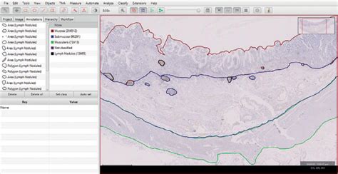 Image result for QuPath Image Analysis