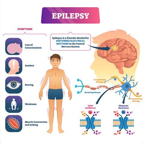 Epilepsy Causes Chart
