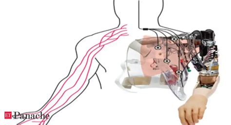 Image result for Bionic Arm Development